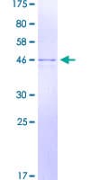 Human RALA / RAL Protein (Recombinant GST)
