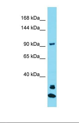 JAKMIP3 Antibody (N-Terminus)