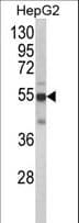 CYP2J2 Antibody (aa96-124)
