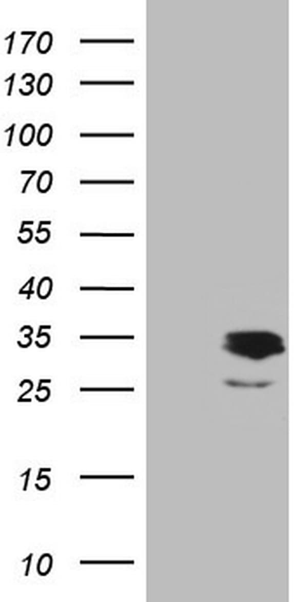 Monoclonal Mouse anti-Human APOE / Apolipoprotein E Antibody (clone OTI3D3, Carrier-free, IHC, WB)