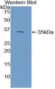 FCN1 / Ficolin-1 Antibody (aa25-317, APC)