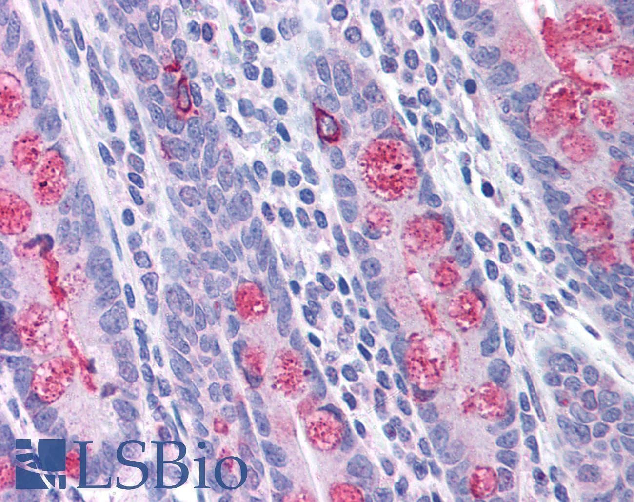 IHC-plus™ Polyclonal Rabbit anti-Human TLR1 Antibody (IHC, WB)
