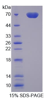 Rat MFGE8 /Lactadherin Protein (Recombinant His-GST, N-terminus)