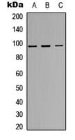 Polyclonal Rabbit anti-Human INSR / Insulin Receptor Antibody (C-Terminus, IHC, WB)