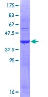 Human IL1A / IL-1 Alpha Protein (Recombinant GST, N-terminus)