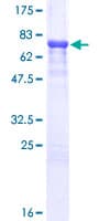 Human A1BG Protein (Recombinant GST)
