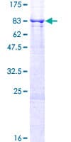 Human CYP4V2 Protein (Recombinant GST)