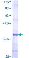 Human C5AR1 / CD88 / C5a Receptor Protein (Recombinant GST, N-terminus)