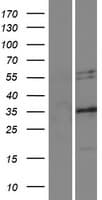 RTN4 / Nogo Protein (Over-Expression Lysate Myc-DDK (Flag))