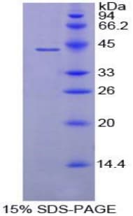 Mouse Complement C8b Protein (Recombinant His-T7)