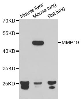 Polyclonal Rabbit anti-Human MMP19 Antibody (IHC, WB)