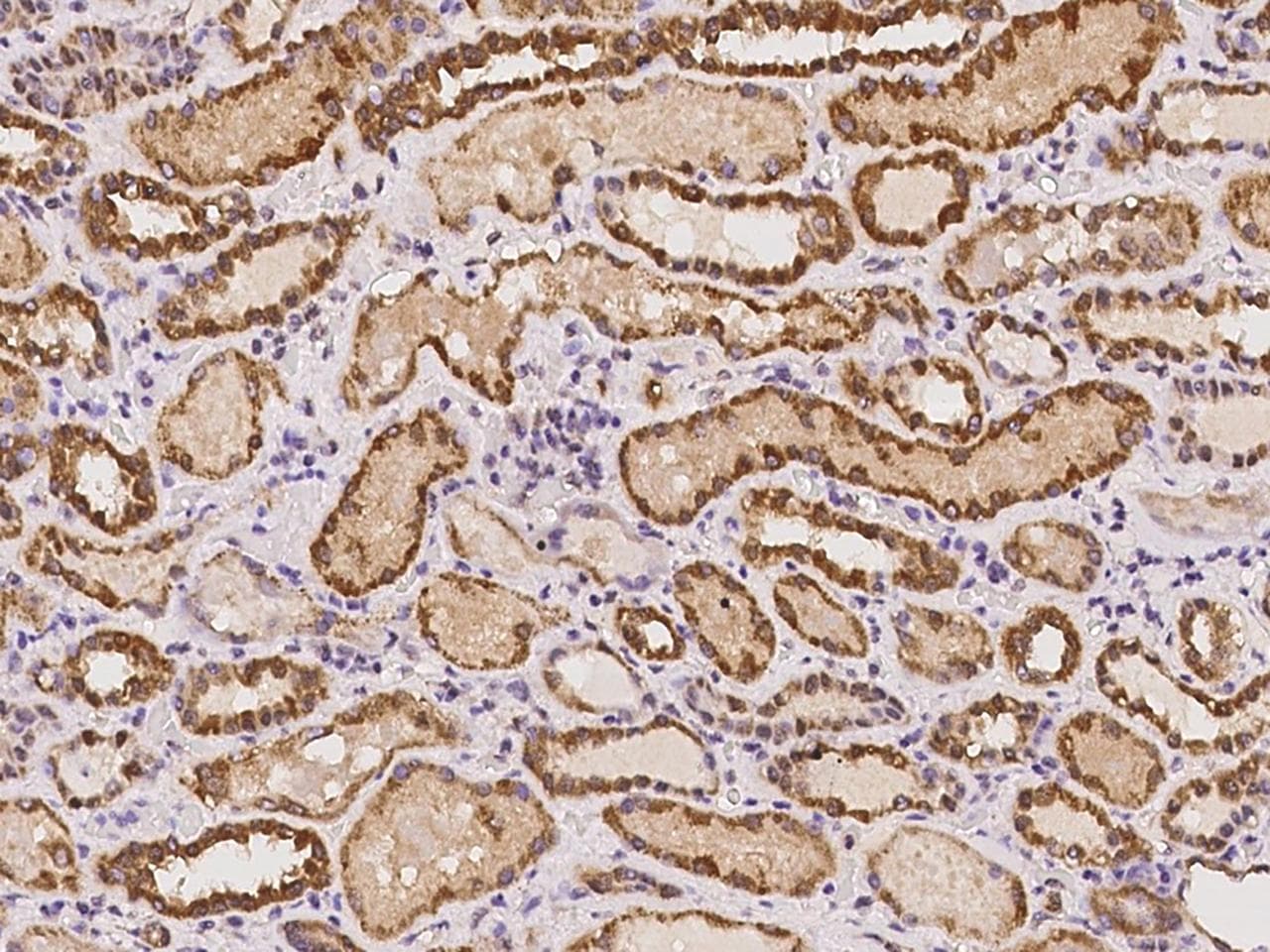Polyclonal Rabbit anti-Human C20orf96 Antibody (IHC)