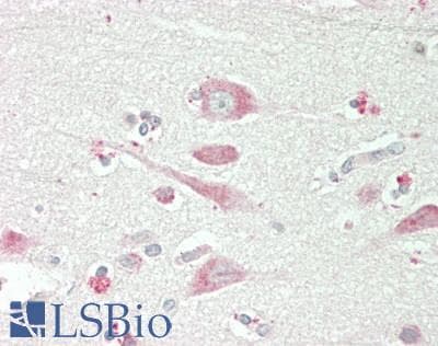 IHC-plus™ CAPRIN1 Antibody (aa550-600)