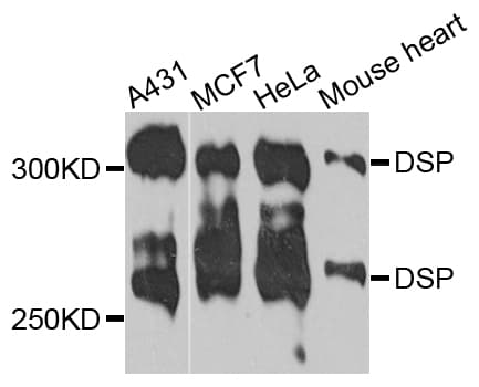 DSP / Desmoplakin Antibody
