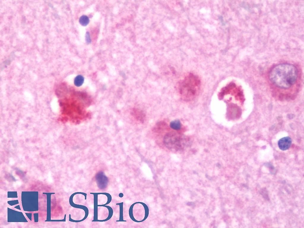 IHC-plus™ PRKCA / PKC-Alpha Antibody (aa75-103)