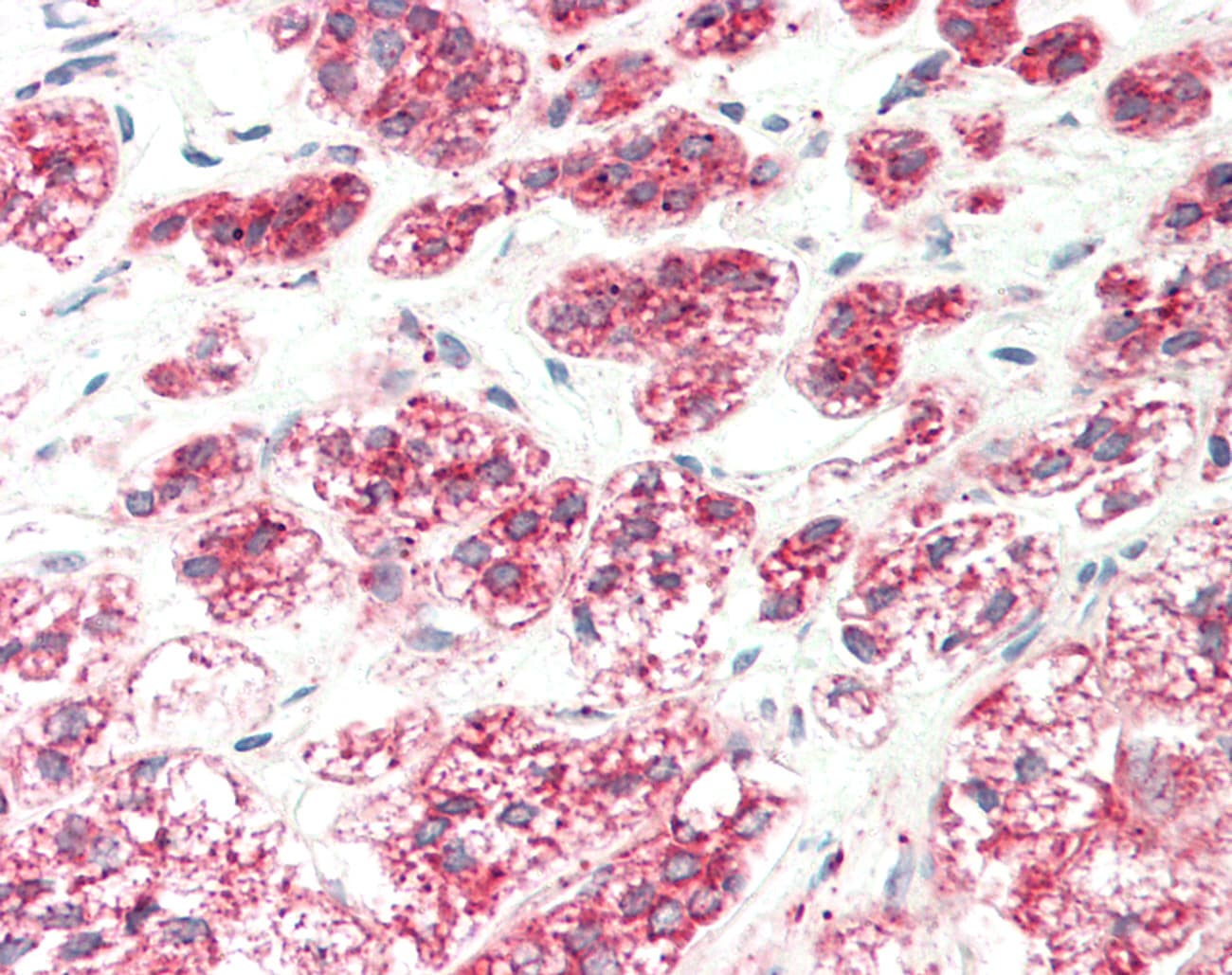 EGLN3 / PHD3 Antibody (C-Terminus)