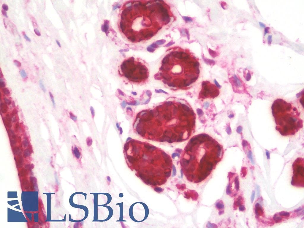 IHC-plus™ KREMEN1 / KREMEN-1 Antibody