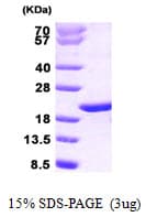 Human PTGES3 / p23 Protein (Recombinant)