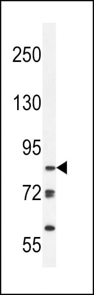 KDM3B / JMJD1B Antibody (aa869-897)