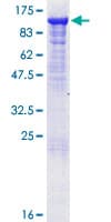 Human MALT1 Protein (Recombinant GST, N-terminus)