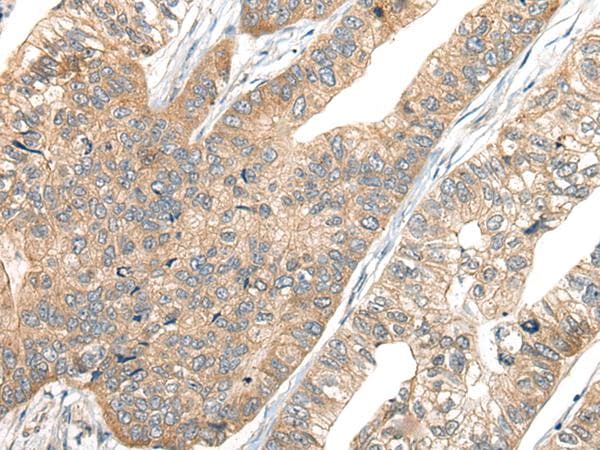 CA7 / Carbonic Anhydrase VII Antibody