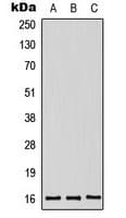 Polyclonal Rabbit anti-Human MDK / Midkine Antibody (Internal, WB)