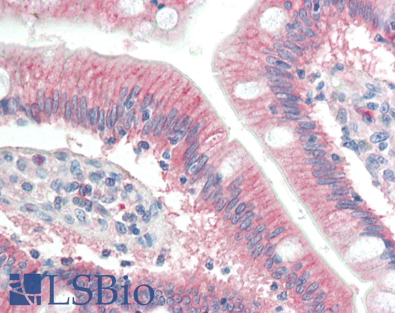 IHC-plus™ RNF39 Antibody (aa407-420)