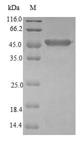Human CDO1 / Cysteine Dioxygenase Protein (Recombinant GST, N-terminus)
