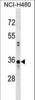 CCDC137 Antibody (aa260-289)