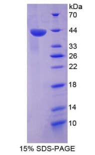 Human TP53 / p53 Protein (Recombinant His-GST)