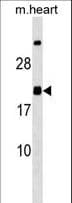 MED9 Antibody (aa107-136)