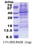 Human FUT3 Protein (Recombinant His)