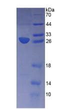 Human APOM / Apolipoprotein M (Recombinant His-S)