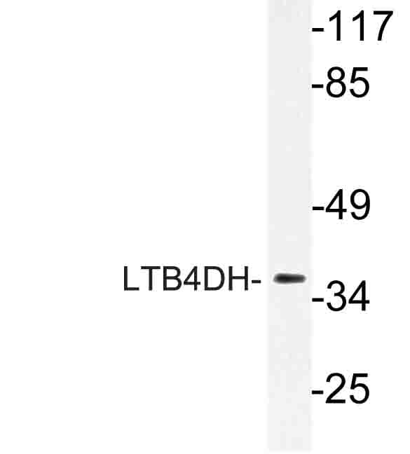 PTGR1 / LTB4DH Antibody (Leu105)