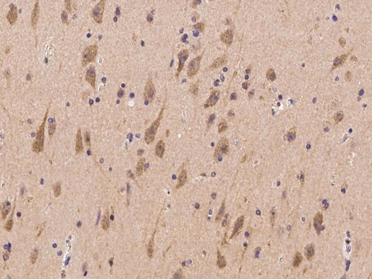 TNRC6B Antibody