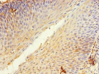 KIR3DL3 / CD158z Antibody