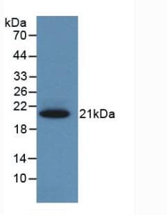 SERPINA6 / CBG Antibody
