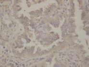 HSP90 / Heat Shock Protein 90 Antibody (aa676-693)