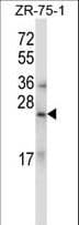 RLN1 + RLN2 / Relaxin 1+2 Antibody (aa136-165)