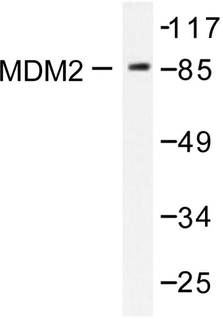 Polyclonal Rabbit anti-Human MDM2 Antibody (Ser160, IHC, IF, WB)
