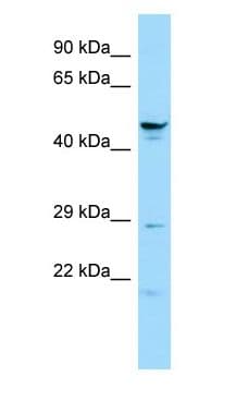 SPATA6 / SRF-1 Antibody (aa382-431)