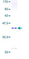 Human CNN1 / Calponin Protein (Recombinant GST)