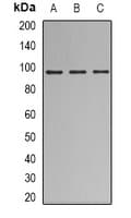 NBN / Nibrin Antibody (Internal)