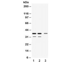 DDAH1 Antibody