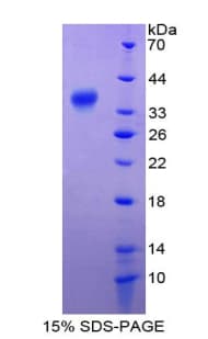 Human RELA / NFKB p65 Protein (Recombinant His-T7)