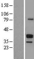 FCER2 / CD23 Protein (Over-Expression Lysate Myc-DDK (Flag))