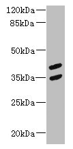 Polyclonal Rabbit anti-Human MAGEB10 Antibody
