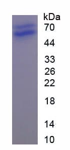 Mouse SELPLG / PSGL-1 / CD162 Protein (Recombinant His-GST-S)