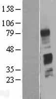 Human C4BPB / C4BP Beta Protein (Over-Expression Lysate Myc-DDK (Flag))