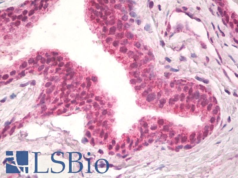 IHC-plus™ NPR3 Antibody (aa520-533)